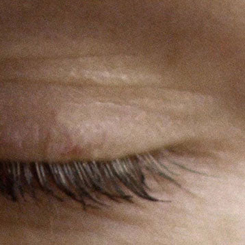 Eye & Lip Care